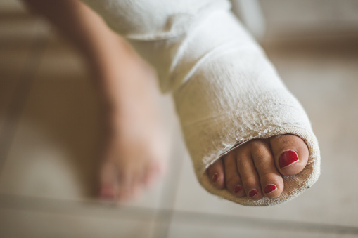 Phụ nữ phòng tránh chấn thương chân như thế nào?